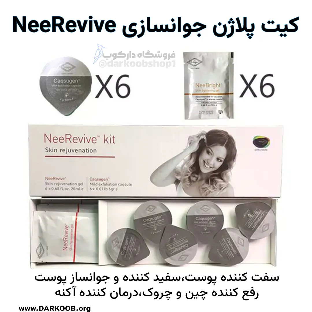 شیسشس 1